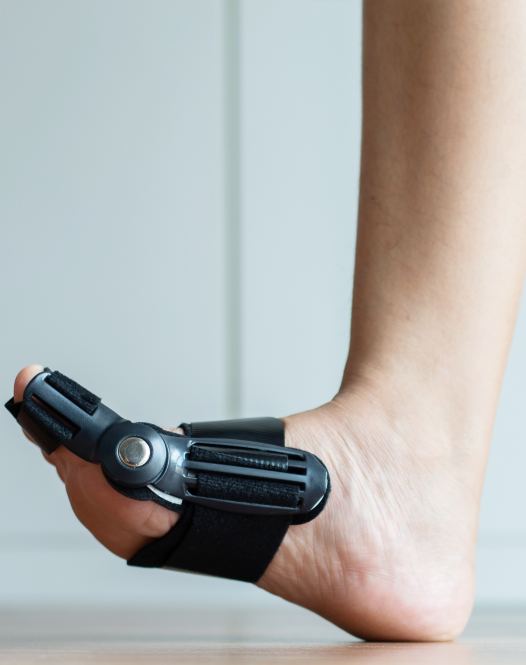 Behandlung bei Hallux rigidus