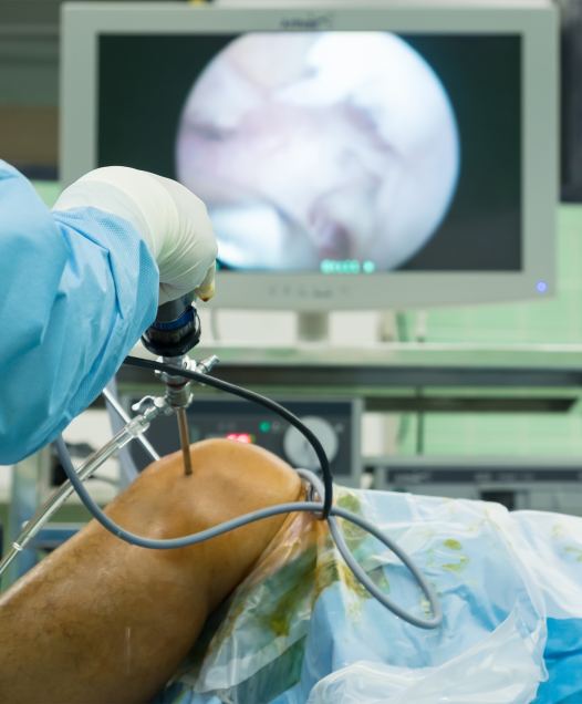 Behandlung eines vorderen Kreuzbandrisses in Düsseldorf